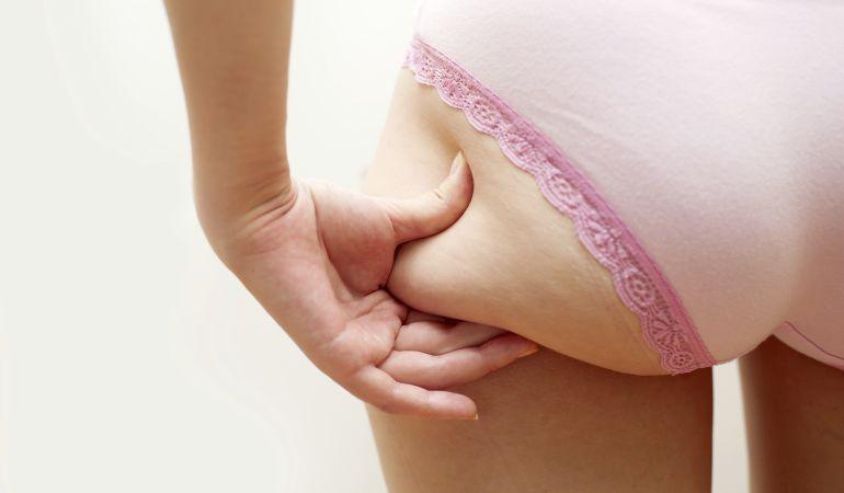 Dile adiós a la celulitis y luce una piel Radiante.